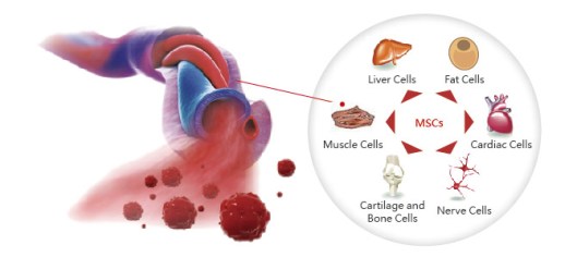 umbilcial-cord-stem-cell-therapy